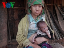 dau long be 3 thang tuoi o son la da boc xuong vi khat sua