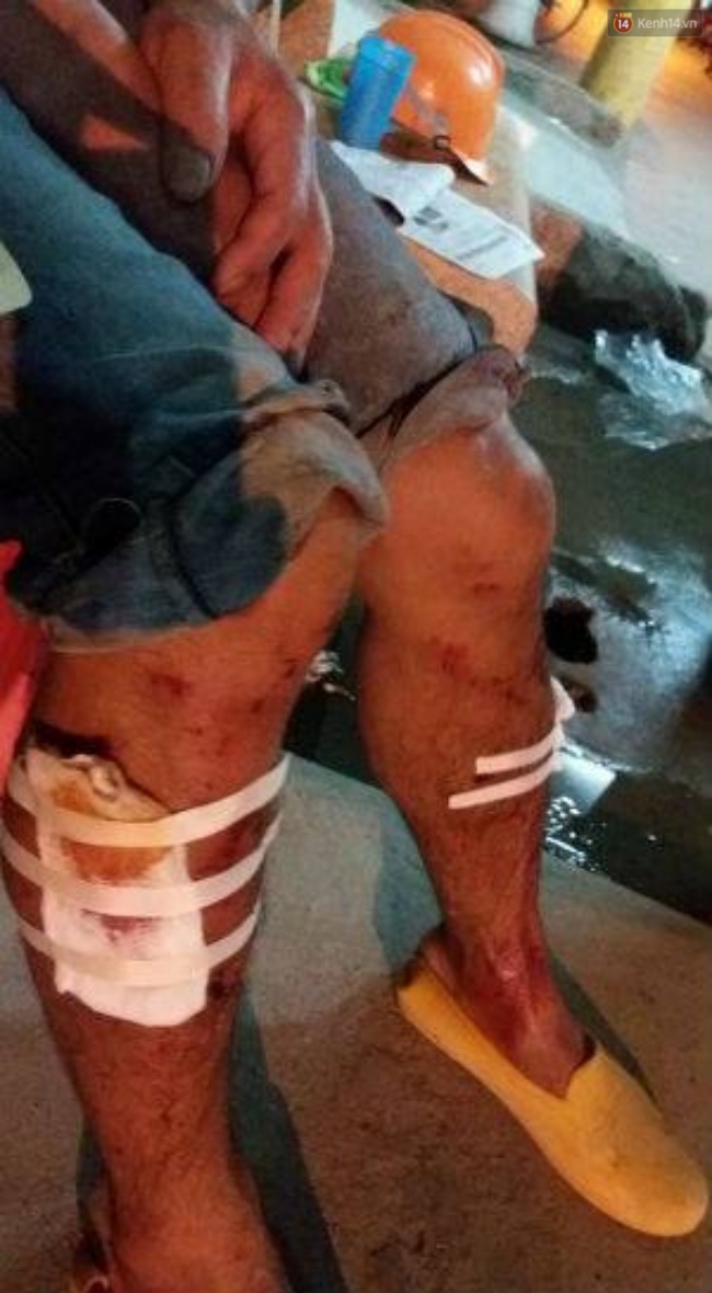 ha noi sap gian giao tai du an khu chung cu cao cap 3 nguoi bi thuong