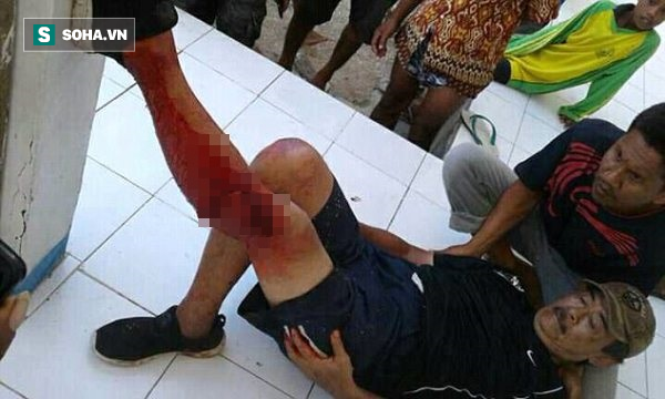 phot lo canh bao mot du khach bi rong komodo tan cong da man