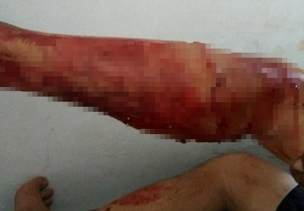 phot lo canh bao mot du khach bi rong komodo tan cong da man