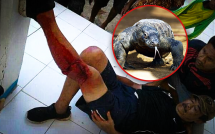 phot lo canh bao mot du khach bi rong komodo tan cong da man