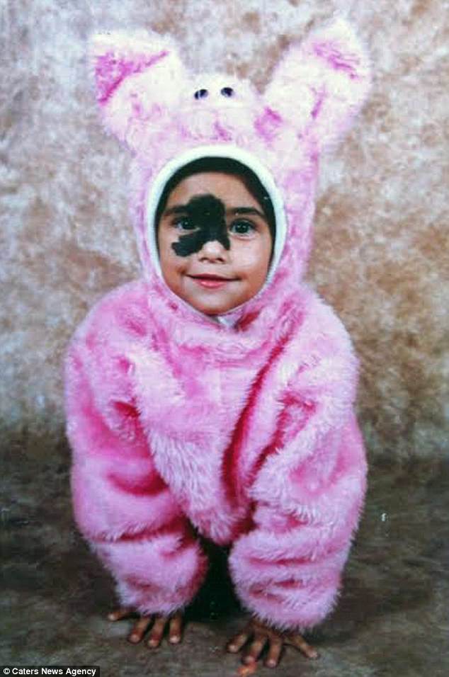 sinh ra da co vet bot sam mau tren mat 24 nam sau co gai thuc su toa sang voi ve dep la cua minh