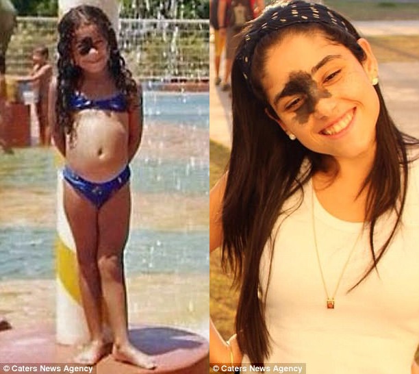 sinh ra da co vet bot sam mau tren mat 24 nam sau co gai thuc su toa sang voi ve dep la cua minh