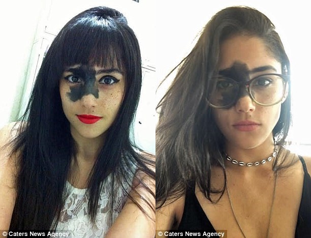 sinh ra da co vet bot sam mau tren mat 24 nam sau co gai thuc su toa sang voi ve dep la cua minh