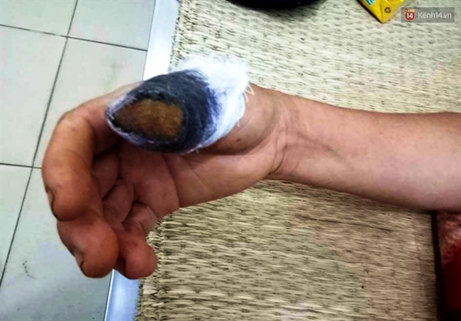 nghe an can dut ngon tay cai cua hang xom vi dam hai rau khong xin phep