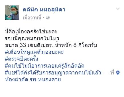 tuong beo phi benh nhan di kham va phat hien ra khoi u khong lo trong buong trung nang 8kg