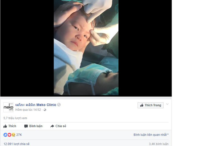 thanh nien cung ti hon quyet khong khoc du bi bac si khau song vet thuong tren tran