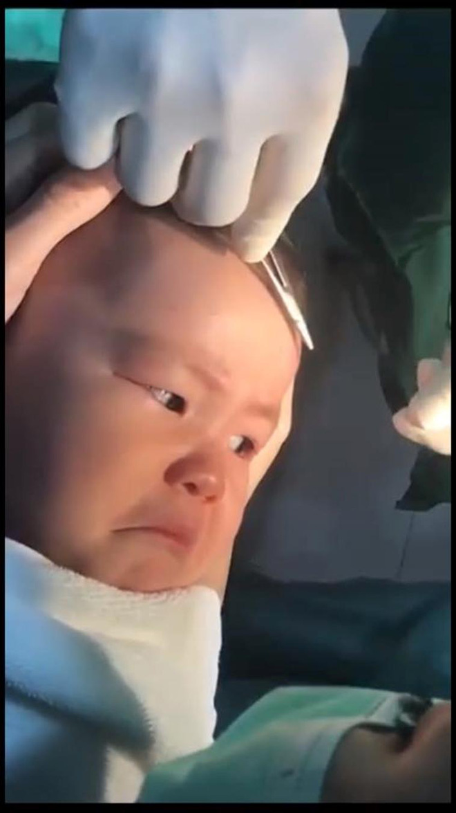 thanh nien cung ti hon quyet khong khoc du bi bac si khau song vet thuong tren tran