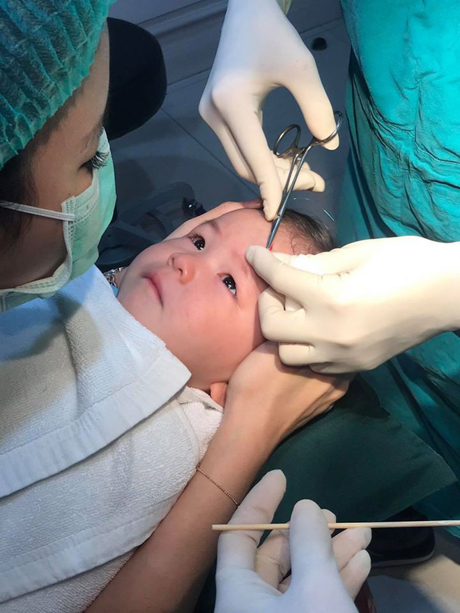 thanh nien cung ti hon quyet khong khoc du bi bac si khau song vet thuong tren tran