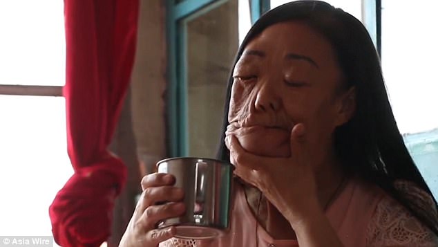 nguoi phu nu khong may co bo mat chay se nhu cao su