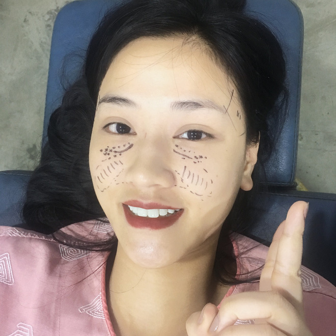 sao viet dang co xu huong cong khai qua trinh phau thuat tham my tren mang xa hoi