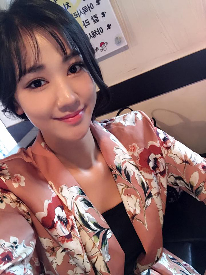sao viet dang co xu huong cong khai qua trinh phau thuat tham my tren mang xa hoi