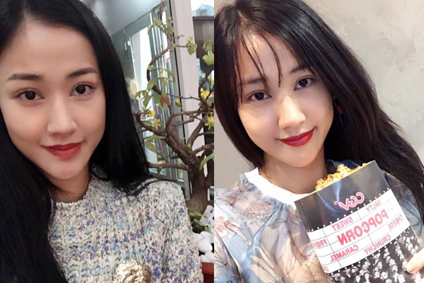sao viet dang co xu huong cong khai qua trinh phau thuat tham my tren mang xa hoi