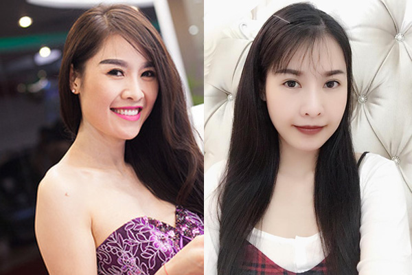 sao viet dang co xu huong cong khai qua trinh phau thuat tham my tren mang xa hoi