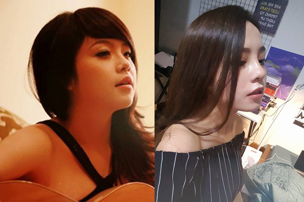 sao viet dang co xu huong cong khai qua trinh phau thuat tham my tren mang xa hoi