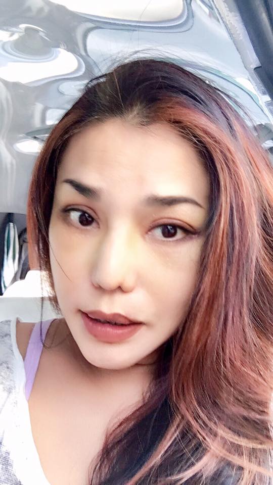 sao viet dang co xu huong cong khai qua trinh phau thuat tham my tren mang xa hoi
