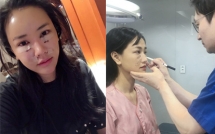 sao viet dang co xu huong cong khai qua trinh phau thuat tham my tren mang xa hoi