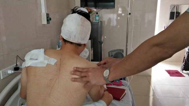 ha noi nguoi dan ong bi 2 thanh nien la mat chem trong thuong tai san chung cu cao cap