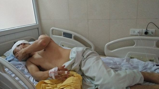 ha noi nguoi dan ong bi 2 thanh nien la mat chem trong thuong tai san chung cu cao cap