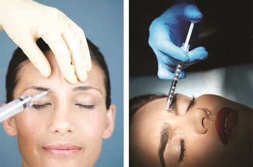 gan 100 nguoi bi mu vi tiem chat don da botox