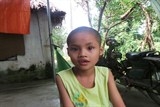be mac benh sac com co van the bao thai bo me khong du suc chay chua
