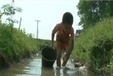 xot xa canh cau be len 10 nuoi ba 70 tuoi bo bi benh tam than