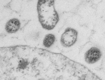 buoc tien moi trong phuong phap su dung virus nhan tao de tieu diet te bao ung thu