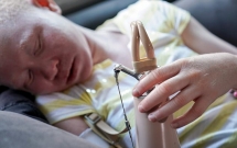 niem vui nho nho den voi nhung dua tre bach tang bi san lung cuop chan tay lam bua phep