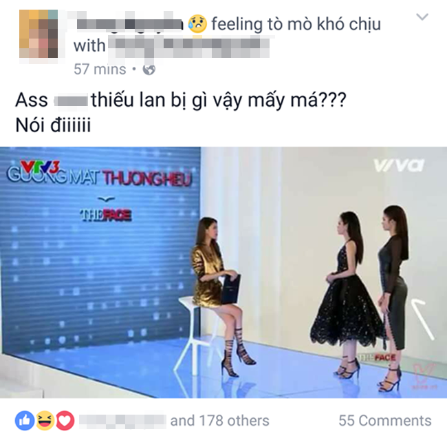 bi loai thi cho thieu lan con bi cu dan mang soi vong 3 ngoai co bat thuong