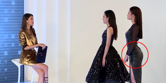 bi loai thi cho thieu lan con bi cu dan mang soi vong 3 ngoai co bat thuong