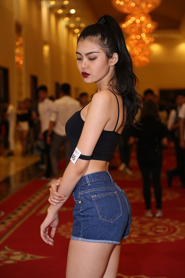 bi loai thi cho thieu lan con bi cu dan mang soi vong 3 ngoai co bat thuong