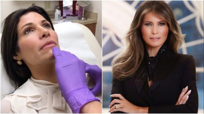 sau ivanka trump den luot de nhat phu nhan my melania tro thanh mieng moi beo bo cho cac tham my vien