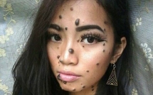 mac du co hang tram not ruoi khap co the the nhung co gai nay van tu tin di thi hoa hau hoan vu