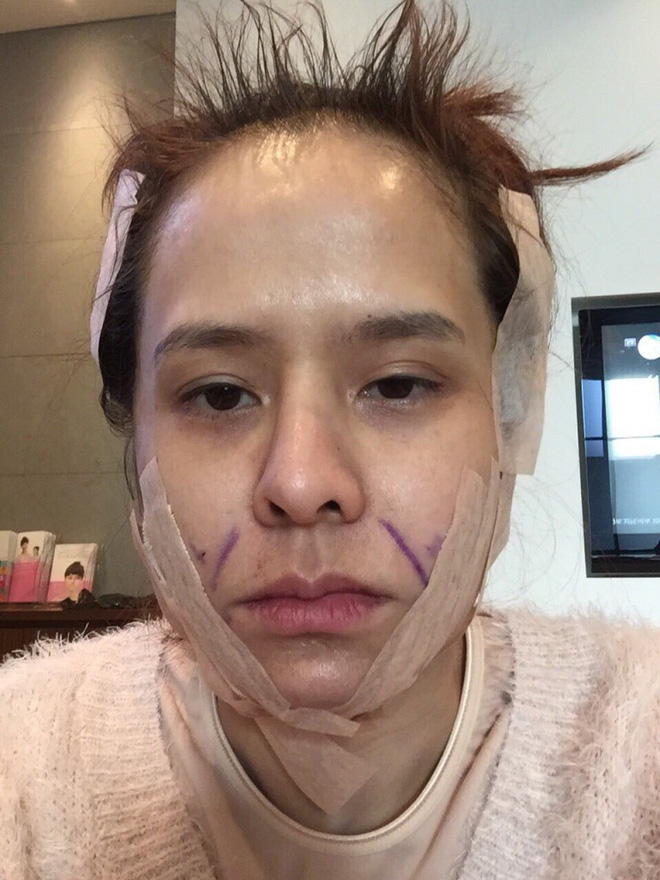 thai lan dap mat di xay lai co gai tre co cuoc song moi vo cung sang chanh hanh phuc