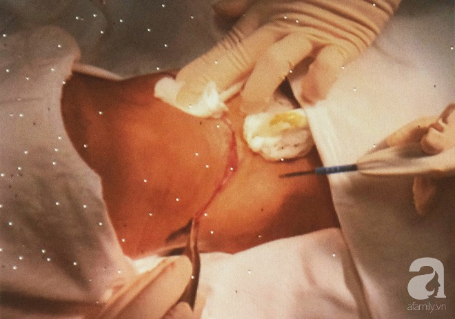 bac si viet cuu chang trai campuchia 2 nam troi khong noi khong tho duoc bang mui