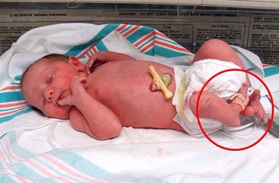 khi quyet dinh cat bo chan con gai so sinh chac nguoi me khong dam nghi den tinh trang hien tai cua con