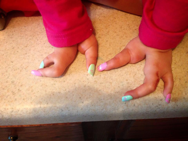 khi quyet dinh cat bo chan con gai so sinh chac nguoi me khong dam nghi den tinh trang hien tai cua con