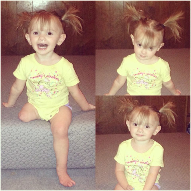 khi quyet dinh cat bo chan con gai so sinh chac nguoi me khong dam nghi den tinh trang hien tai cua con