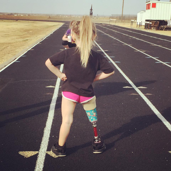 khi quyet dinh cat bo chan con gai so sinh chac nguoi me khong dam nghi den tinh trang hien tai cua con