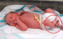 khi quyet dinh cat bo chan con gai so sinh chac nguoi me khong dam nghi den tinh trang hien tai cua con