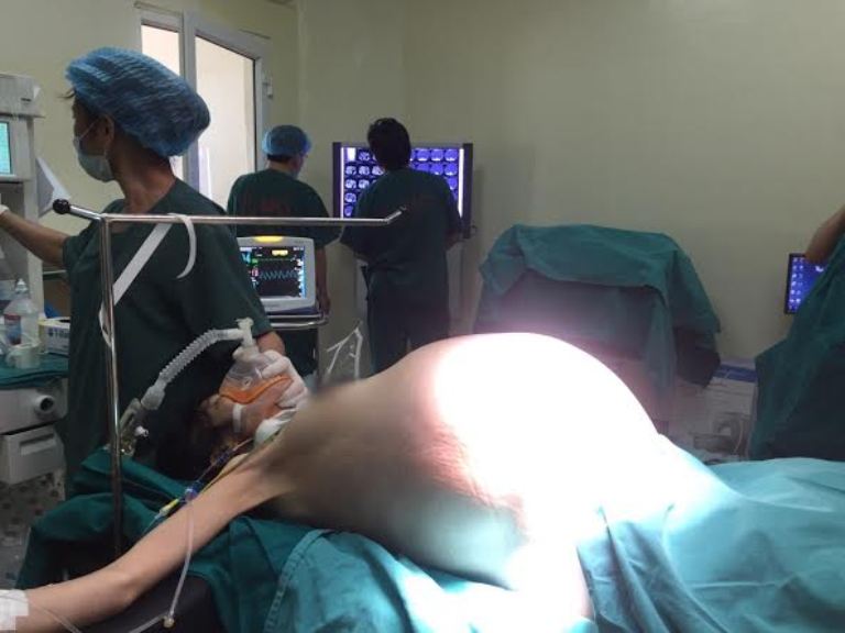 phau thuat thanh cong cho co gai mang khoi u buong trung nang 16kg