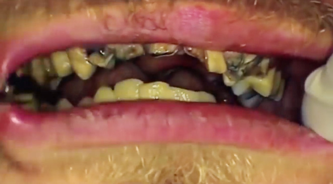 anh chang khong bao gio cuoi vi suot 20 nam chang chiu danh rang noi lay mot lan