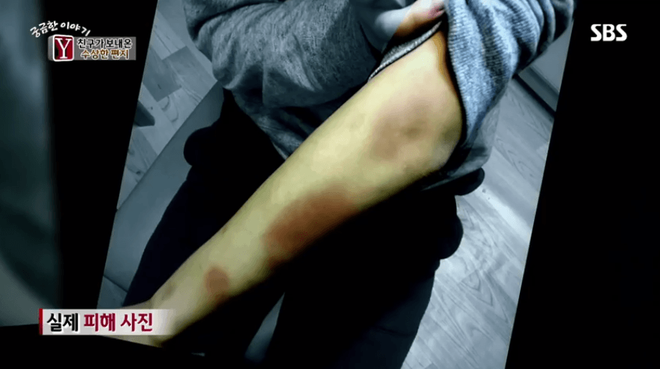 han quoc 3 hoc sinh trung hoc bat coc ban than nhot va tra tan suot 10 ngay