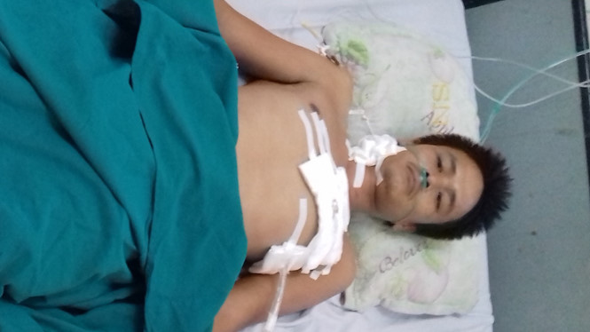 cuu song benh nhan bi dam thung tim