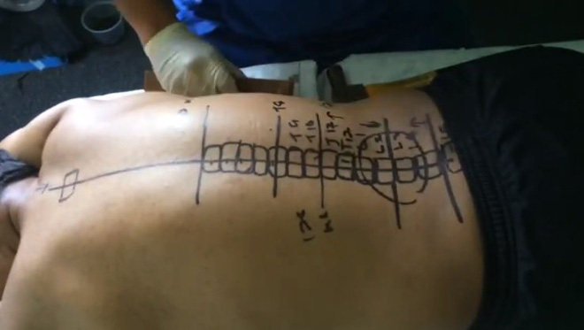 go bua de chua benh cot song bac si dao van dong khach nuom nuop