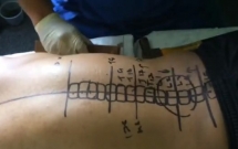 go bua de chua benh cot song bac si dao van dong khach nuom nuop