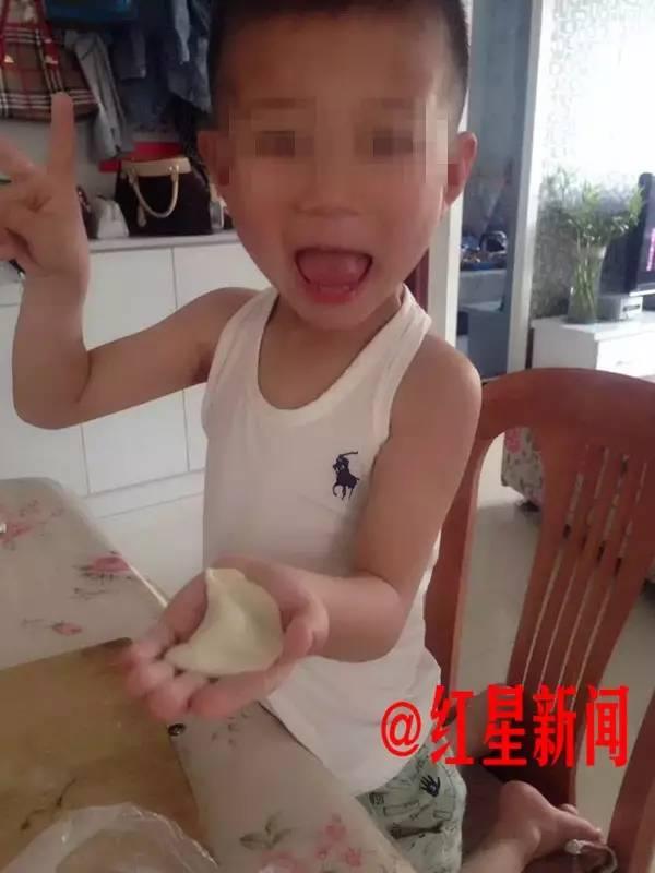 bi me ke nguoc dai da man cau be 6 tuoi chan thuong so nao nghiem trong