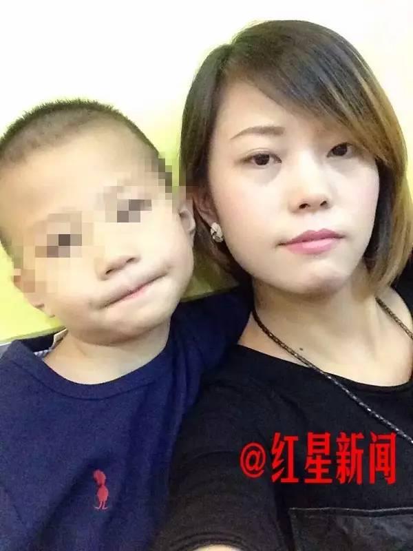 bi me ke nguoc dai da man cau be 6 tuoi chan thuong so nao nghiem trong