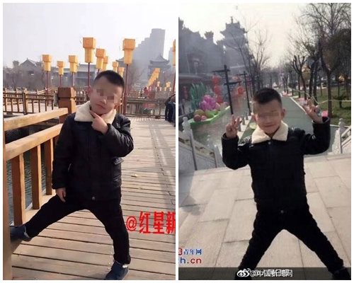 bi me ke nguoc dai da man cau be 6 tuoi chan thuong so nao nghiem trong