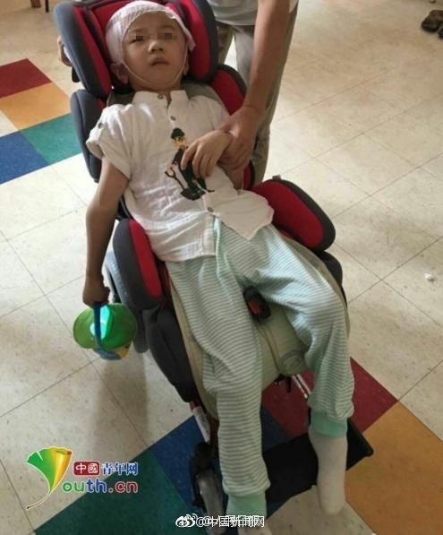 bi me ke nguoc dai da man cau be 6 tuoi chan thuong so nao nghiem trong